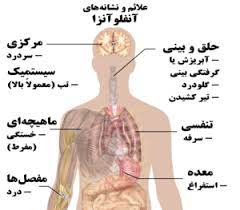 پاورپوینت آنفولانزا